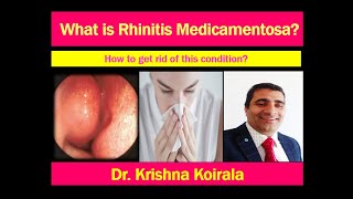 Rhinitis medicamentosa Rebound nasal congestion Dr Krishnas ENT Lectures  Manipal Pokhara [upl. by Nye215]