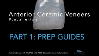 Anterior Ceramic Veneers Part 1 Preparation Guides [upl. by Sutit162]