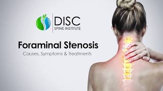 Pinched Nerve in Neck or Back Foraminal Stenosis Causes Symptoms Treatments [upl. by Faus]