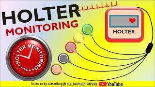 HOLTER Monitoring  Ambulatory ECG  24 Hour ECG or Ambulatory ECGEKG  Nursing considerations [upl. by Alyak]