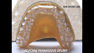 CADCAM Permissive Splint by MIK Dental Lab TMJ TMD [upl. by Nwahsed]