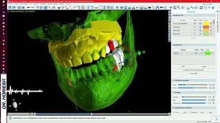 CURSO ¬ Tomografia Cone Beam Dental e Impresión 3D en Odontología Digital [upl. by Atcliffe]