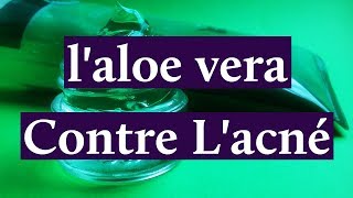 Comment Utiliser laloe Vera Pour Lacné [upl. by Akihc]