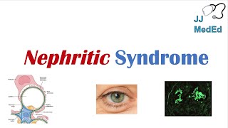 Nephritic Syndrome  Clinical Presentation Causes and Treatment [upl. by Ewan]