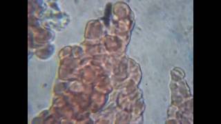 Blood Cells 1500X Magnification [upl. by Vod]