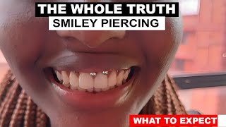 Smiley Piercing  WHAT TO EXPECT  PROCESS [upl. by Sioux]