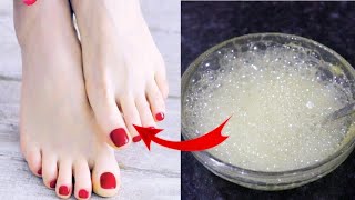 Feet cleaning Home Remedy  DIY Home Made Mixture For Clean and Glowing Feet [upl. by Tallu843]