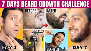 7 DAYS BEARD GROWTH CHALLENGE How To Grow A Beard FAST DERMA ROLLER VS BEARD OIL FIX PATCHY BEARD [upl. by Ha]