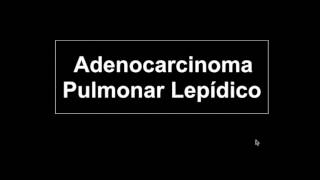 Adenocarcinoma pulmonar de crescimento lepídico [upl. by Samot]