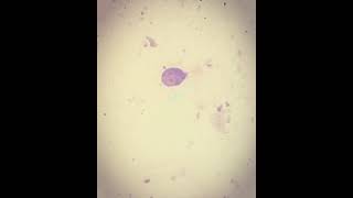 Giardia lamblia por microscopia [upl. by Asatan]