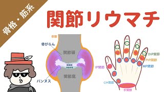 【国試対策】関節リウマチの症状 [upl. by Lindsy]