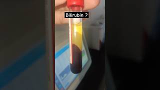 Bilirubin kitna hailab technologist status labstatus shorts pathology bloodtest scienceaiims [upl. by Michel424]