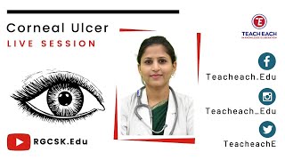 Paramedical Course ∣ Live Class ∣ Corneal Ulcer PII [upl. by Dory]