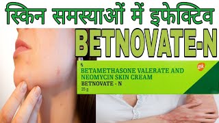 BETNOVATEN Cream Benefits and side effects in Hindi  Betamethasone Neomycin skin cream [upl. by Eilyr413]