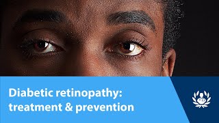 Diabetic retinopathy treatment amp prevention [upl. by Etnelav9]