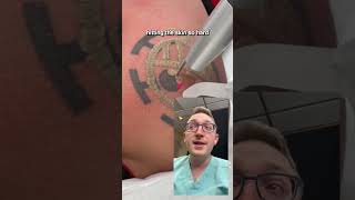 How Does Laser Tattoo Removal Work [upl. by Enitselec]