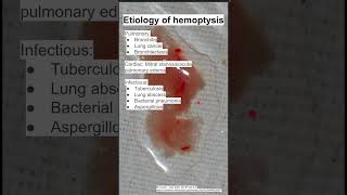 Etiology of hemoptysis [upl. by Weight]