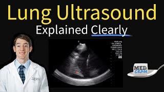 Lung Ultrasound Explained Point of Care Bedside Clinical [upl. by Lairea138]