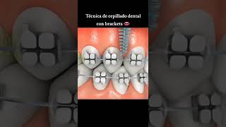 Cepillado dental con brackets parati dentales cepillodental dentista viralfypシ viralshort fyp [upl. by Joseph]