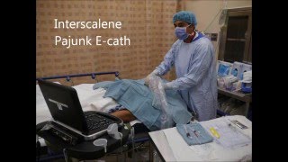 USG Interscalene Catheter Insertion Pajunk Ecath  OutOfPlane Technique [upl. by Emile]