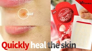 hell pore blemish spot patch of 2019 Best new skin recovery product [upl. by Ahsieni509]