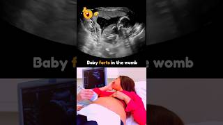 Funny Baby Farts in the Womb😂 Mom Surprised 😯 Just for Fun😂💯 Babies Dont Fart [upl. by Thurnau]