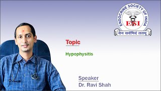 Hypophysitis by Dr Ravi Shah [upl. by Deonne]