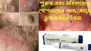 Fungidal HC cream uses  ফানজিডাল এইচ সি ক্রিমের ব্যবহার এবং কাজ  অন্ডকোষে চুলকানির ক্রিম [upl. by Hasty]