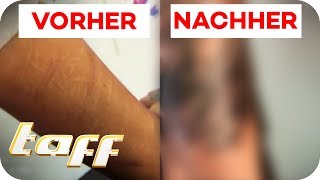 Cover Up für Narben vom Ritzen  taff  ProSieben [upl. by Borgeson]