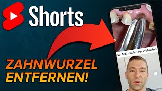 Wurzel ziehen shorts [upl. by Adria675]