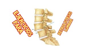 Ejercicios para RETROLISTESIS LUMBAR [upl. by Iuq]