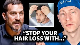 How I Stopped My Receding Hairline Mens Hair Loss Guide [upl. by Teria]