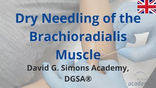 How to treat the Brachioradialis Muscle with Dry Needling  David G Simons Academy DGSA® [upl. by Sidhu]