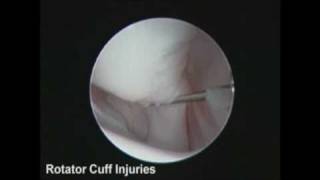 Gulf Coast Veterinary Surgery Shoulder Arthroscopy [upl. by Svirad]