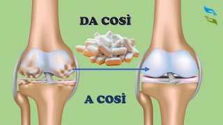 Addio ARTROSI o problemi alla CARTILAGINE con questi 4 integratori naturali [upl. by Anitnahs883]