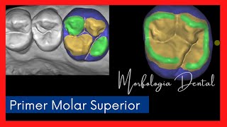 Primer Molar Superior MORFOLOGIA DENTAL💥 [upl. by Otirecul]