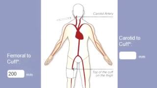 Estudio de Velocidad de Onda de Pulso con el Atcor SphygmoCor Xcel [upl. by Anissej]