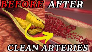 What to Eat to Clean Your Arteries [upl. by Ditter]