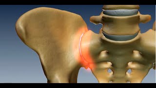 Where is the Sacroiliac Joint Anatomy of the Sacroiliac Joint [upl. by Orimisac]