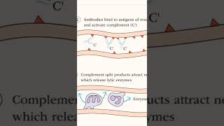 hyperacute rejection of kidney graft [upl. by Sells]