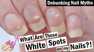 Why do I have white spots on my nails [upl. by Babara]