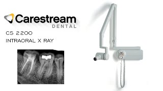 Carestream Dental CS 2200 Intraoral X Ray System [upl. by Eleaffar]