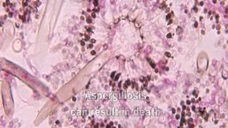 Aspergillus and Aspergillosis [upl. by Harbour]