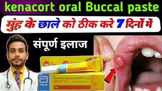 मुंह के छालों की बेस्ट क्रीमkenacort 01 cream uses in hindi triamcinolone acetonide cream usp 01 [upl. by Longerich528]