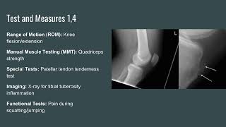 Osgood schlatter [upl. by Anaujat]