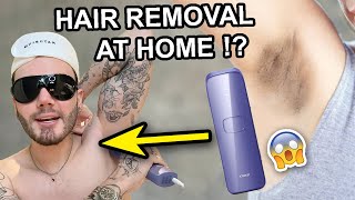 IPL HAIR REMOVAL AT HOME😱 with Ulike  no longer need to shave💗 AD [upl. by Alayne]