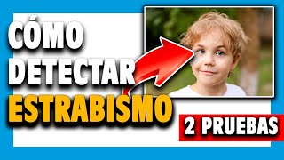 🔵 ¿Cómo saber si tengo ESTRABISMO 👉 Para niños y adultos [upl. by Akerley]