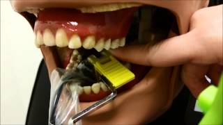 Mandibular Posterior Periapical Technique [upl. by Vaclav]