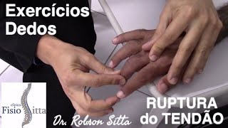 EXERCÍCIOS PARA ARTROSE NOS DEDOS DAS MÃOS FISIOTERAPIA MANUAL Clínica Dr Robson Sitta ® [upl. by Lissa]