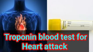 Troponin cTnI cTnT  or troponin I or Troponin T blood test cardiac markers [upl. by London]